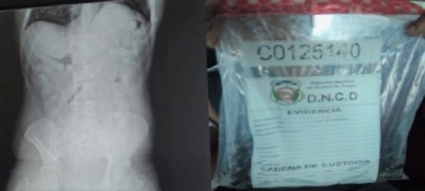 Agentes de la DNCD apresan en el Aeropuerto Las Américas a un venezolano trajo 84 bolsitas de cocaína en las vías digestivas